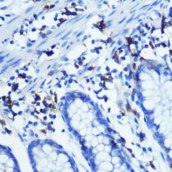 CD3 zeta Rabbit anti-Human, Clone: 1T5R7, Novus Biologicals 100 &mu;g;