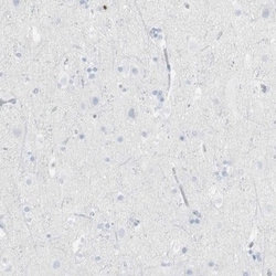 CD3 zeta Antibody, Novus Biologicals 0.1mL; Unlabeled:Antibodies, Polyclonal