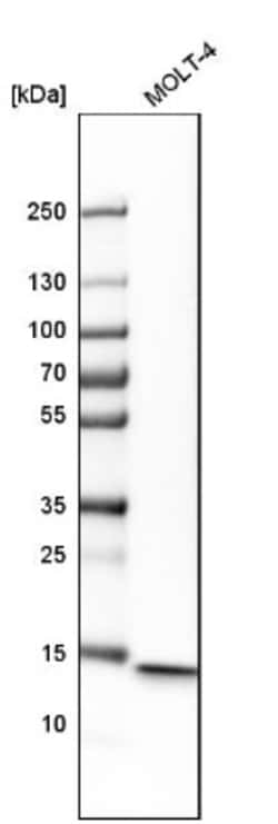 CD3 zeta Antibody, Novus Biologicals 0.1mL; Unlabeled:Antibodies, Polyclonal