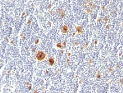 CD30/TNFRSF8 Antibody (Ki-1/779), Novus Biologicals 0.2mg; Unlabeled:Antibodies,