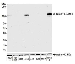 CD31/PECAM-1 Antibody (BLR127H), Novus Biologicals 100 &mu;g | Buy Online | Novus Biologicals | Fisher Scientific