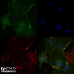 CD31/PECAM-1 Antibody (JC/70A) - BSA Free, Novus Biologicals 0.025mL; Unlabeled:Antibodies,