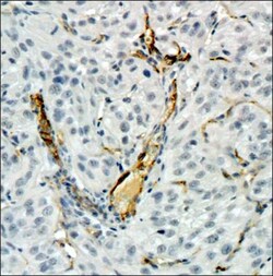 CD34 Antibody (MEC 14.7), Novus Biologicals 0.025mL; Unlabeled:Antibodies,