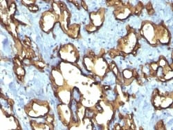 CD34 Antibody (QBEnd/10 + HPCA1/763), Novus Biologicals 0.2mg; Unlabeled:Antibodies,