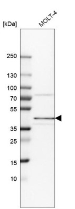 CD34 Antibody, Novus Biologicals 25 &mu;L, Unlabeled:Antibodies, Polyclonal