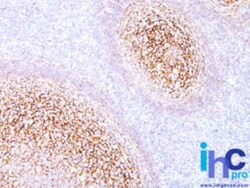 Mouse anti-CD35, Clone: E11, Novus Biologicals 0.2mg; Unlabeled:Antibodies,