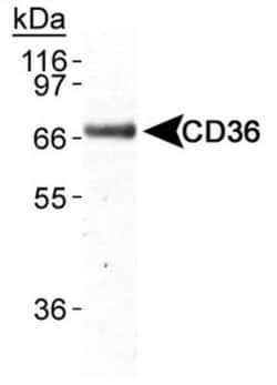 CD36 Antibody (D-2712) - BSA Free, Novus Biologicals 0.1mL; Unlabeled:Antibodies,