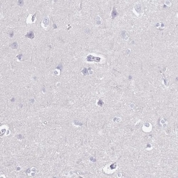CD37 Antibody, Novus Biologicals 0.1mL; Unlabeled:Antibodies, Polyclonal