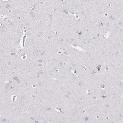 CD37 Antibody, Novus Biologicals:Antibodies:Primary Antibodies