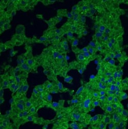 CD38 Antibody (1G7F4) - Azide Free, Novus Biologicals 0.1mg; Unlabeled:Antibodies,