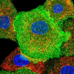 CD38 Antibody, Novus Biologicals 0.1mL; Unlabeled:Antibodies, Polyclonal