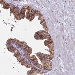 CD38 Antibody, Novus Biologicals 25 &mu;L | Buy Online | Novus Biologicals | Fisher Scientific