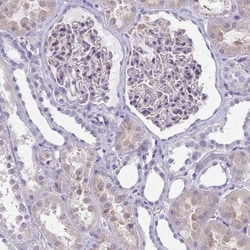 CD38 Antibody, Novus Biologicals 25 &mu;L | Buy Online | Novus Biologicals | Fisher Scientific