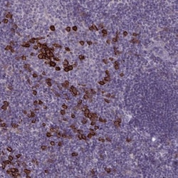 CD38 Antibody, Novus Biologicals 25 &mu;L | Buy Online | Novus Biologicals | Fisher Scientific