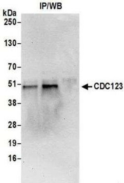 CD38 Antibody (BLR123H), Novus Biologicals 100 &mu;g | Buy Online | Novus Biologicals | Fisher Scientific