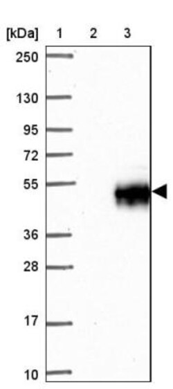 CD38 Antibody, Novus Biologicals 25 &mu;L | Buy Online | Novus Biologicals | Fisher Scientific