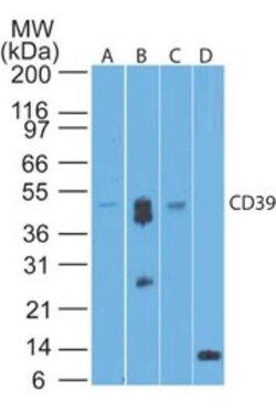 CD39/ENTPD1 Antibody (17B5F11) - BSA Free, Novus Biologicals:Antibodies:Primary