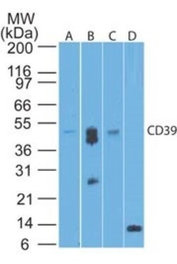 CD39/ENTPD1 Antibody (17B5F11) - BSA Free, Novus Biologicals:Antibodies:Primary