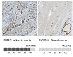 CD39/ENTPD1 Antibody, Novus Biologicals 25 &mu;L; Unlabeled:Antibodies,
