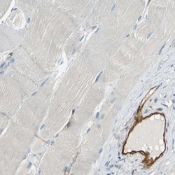 CD39/ENTPD1 Antibody, Novus Biologicals 25 &mu;L; Unlabeled:Antibodies,