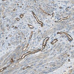 CD39/ENTPD1 Antibody, Novus Biologicals 25 &mu;L; Unlabeled:Antibodies,