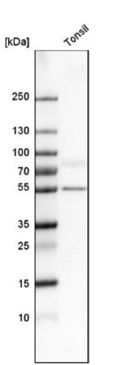 CD39/ENTPD1 Antibody, Novus Biologicals 25 &mu;L; Unlabeled:Antibodies,