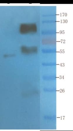 CD4 Antibody (YNB46.1.8 (Campath-9H)) - Chimeric - Azide and BSA Free,