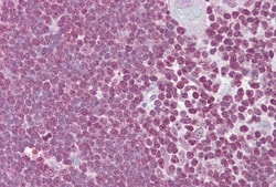 CD40 Ligand/TNFSF5 Antibody, Novus Biologicals 100μL; Unlabeled:Antibodies,