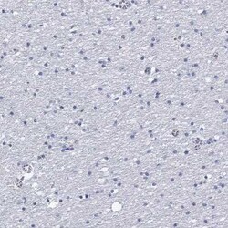 CD40 Ligand/TNFSF5 Rabbit anti-Human, Polyclonal, Novus Biologicals 25 &mu;g | Buy Online | Novus Biologicals | Fisher Scientific