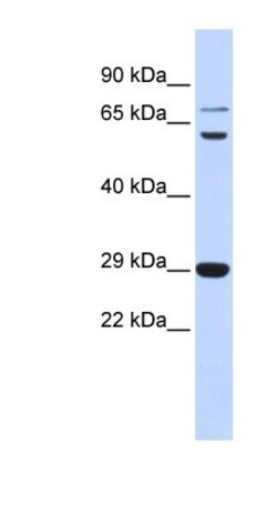 CD40 Ligand/TNFSF5 Antibody, Novus Biologicals 100μL; Unlabeled:Antibodies,