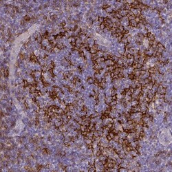 CD40/TNFRSF5 Antibody (CL1673), Novus Biologicals:Antibodies:Primary Antibodies