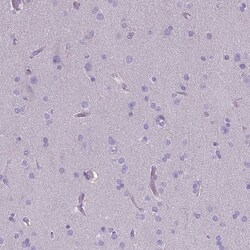CD40/TNFRSF5 Antibody (CL1673), Novus Biologicals:Antibodies:Primary Antibodies