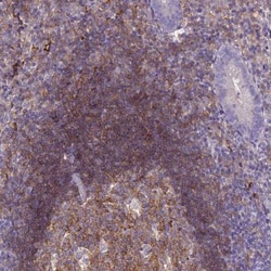 CD40/TNFRSF5 Antibody, Novus Biologicals 0.1mL; Unlabeled:Antibodies, Polyclonal