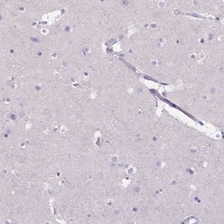 CD40/TNFRSF5 Antibody, Novus Biologicals 0.1mL; Unlabeled:Antibodies, Polyclonal