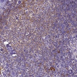 CD40/TNFRSF5 Antibody, Novus Biologicals 0.1mL; Unlabeled:Antibodies, Polyclonal