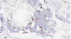 CD42b/GPIb alpha Antibody (MM2/174), Novus Biologicals 0.1mg; Unlabeled:Antibodies,