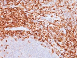 CD43/Sialophorin Antibody (DF-T1), Novus Biologicals 0.2mg; Unlabeled:Antibodies,