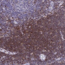 CD43/Sialophorin Antibody, Novus Biologicals:Antibodies:Primary Antibodies