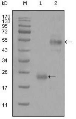 CD44 Antibody (8E2F3) - BSA Free, Novus Biologicals 0.025 mL | Buy Online | Novus Biologicals | Fisher Scientific