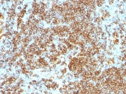 CD45RB Antibody (PTPRC/1132), Novus Biologicals 0.2mg; Unlabeled:Antibodies,