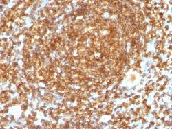 CD45RB Antibody (PTPRC/1132), Novus Biologicals 0.2mg; Unlabeled:Antibodies,