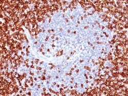 CD45RO Antibody (T200/797), Novus Biologicals 0.2mg; Unlabeled:Antibodies,