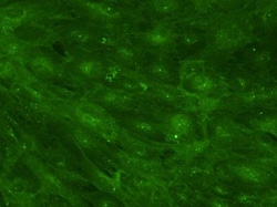 CD47 Antibody (B6H12.2) - Azide and BSA Free, Novus Biologicals:Antibodies:Primary