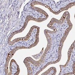 CD47 Antibody, Novus Biologicals 0.1mL; Unlabeled:Anticorps, Polyclonal