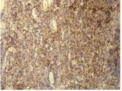 CD5 Antibody (A25-G), Novus Biologicals:Antibodies:Primary Antibodies