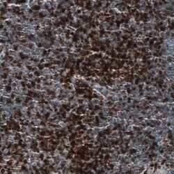 CD5 Mouse anti-Human, Clone: CL12334, Novus Biologicals 25 &mu;g | Buy Online | Novus Biologicals | Fisher Scientific