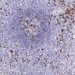 CD5 Antibody, Novus Biologicals 25 &mu;L, Unlabeled:Antibodies, Polyclonal
