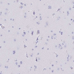 CD5 Antibody, Novus Biologicals 25 &mu;L, Unlabeled:Antibodies, Polyclonal