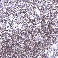 CD5 Antibody, Novus Biologicals 25 &mu;L, Unlabeled:Antibodies, Polyclonal