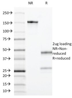 CD55/DAF Antibody (F4-29D9), Novus Biologicals 0.2mg; Unlabeled:Antibodies,